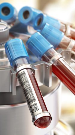 Blood test tubes in centrifuge