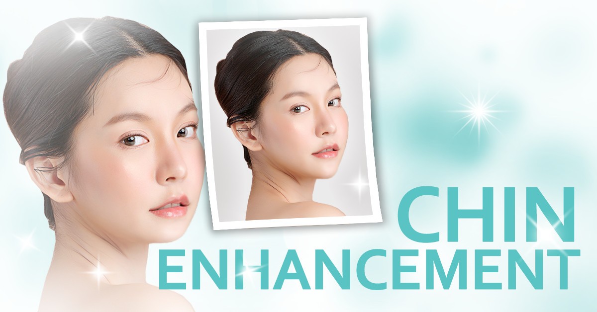 Chin Enhancement