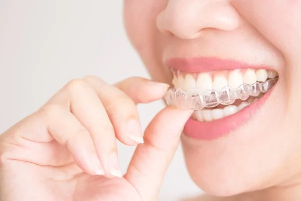 clear aligners penang