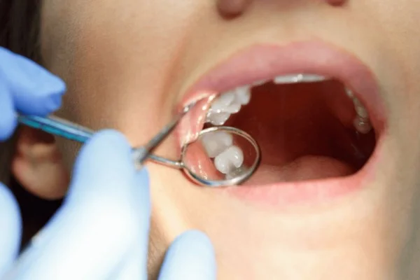 dental filling penang