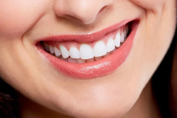 smile makeover penang
