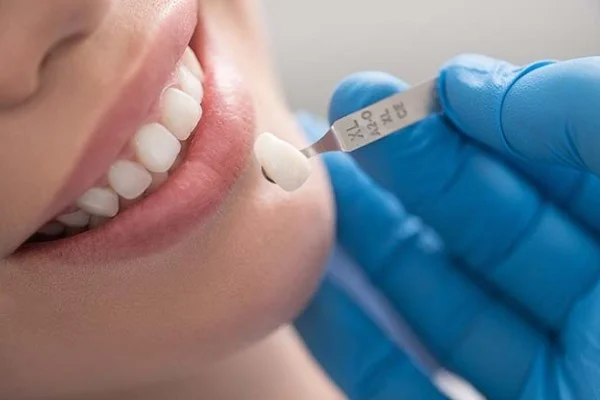 veneers penang