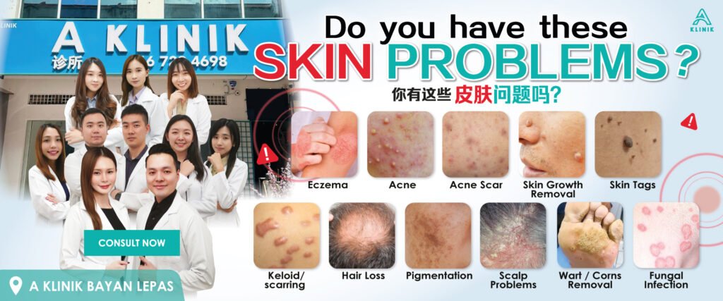 Are you struggling with eczema, acne, acne scar, skin growth removal, skin tags, keloid, hair loss, pigmentation, scalp problems, wart / corns removal or fungal infection ? A Klinik Bayan Lepas, Penang can help