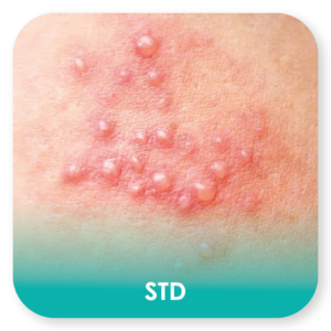 std
