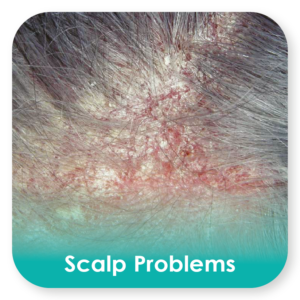 scalp problems