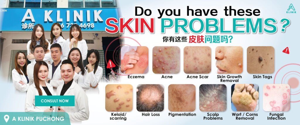Are you struggling with eczema, acne, acne scar, skin growth removal, skin tags, keloid, hair loss, pigmentation, scalp problems, wart / corns removal or fungal infection ? A Klinik can help
