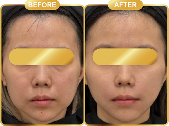 before & after-52