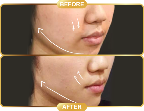 before & after-54