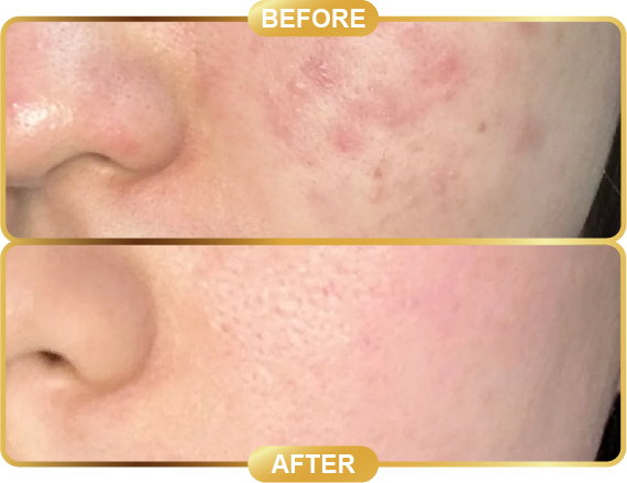 before & after-58