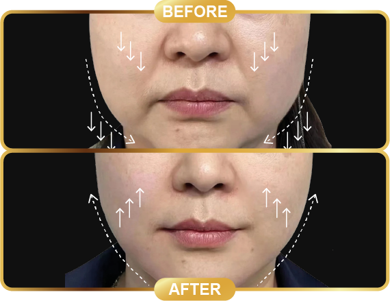 before & after-59