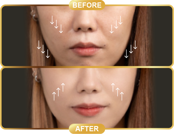 before & after-60