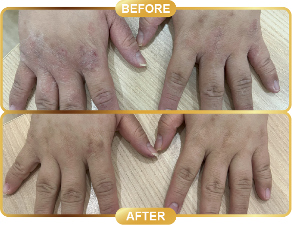 before & after-61