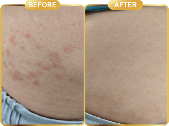 before & after-62