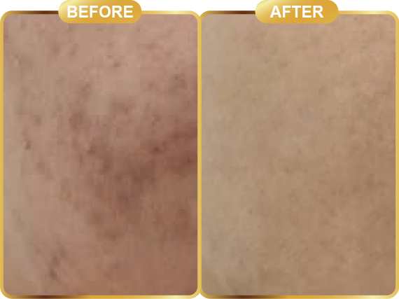 before & after-63
