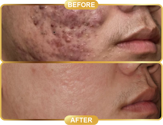 before & after-64