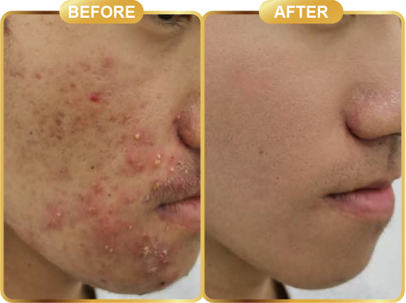 before & after-65