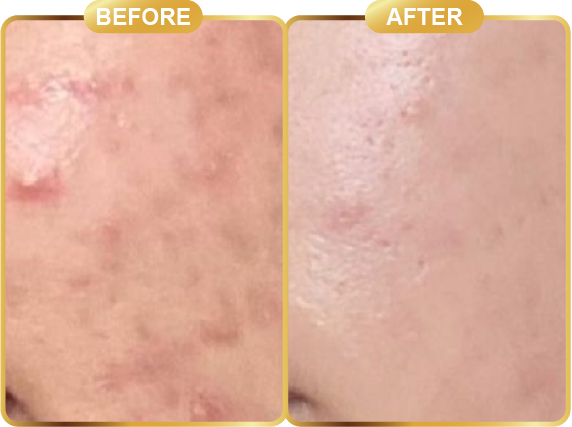 before & after-66