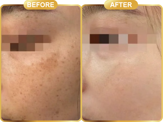before & after-67
