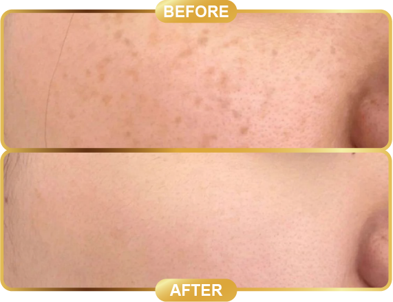 before & after-68