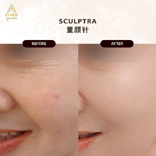 20250723_AKS_Sculptra Website-19