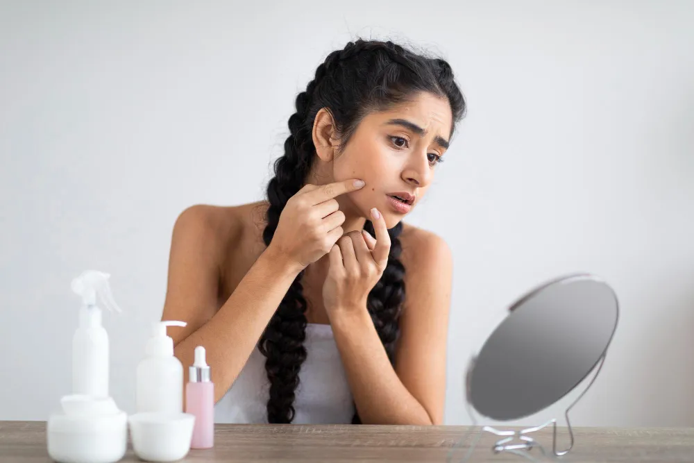 acne treatment