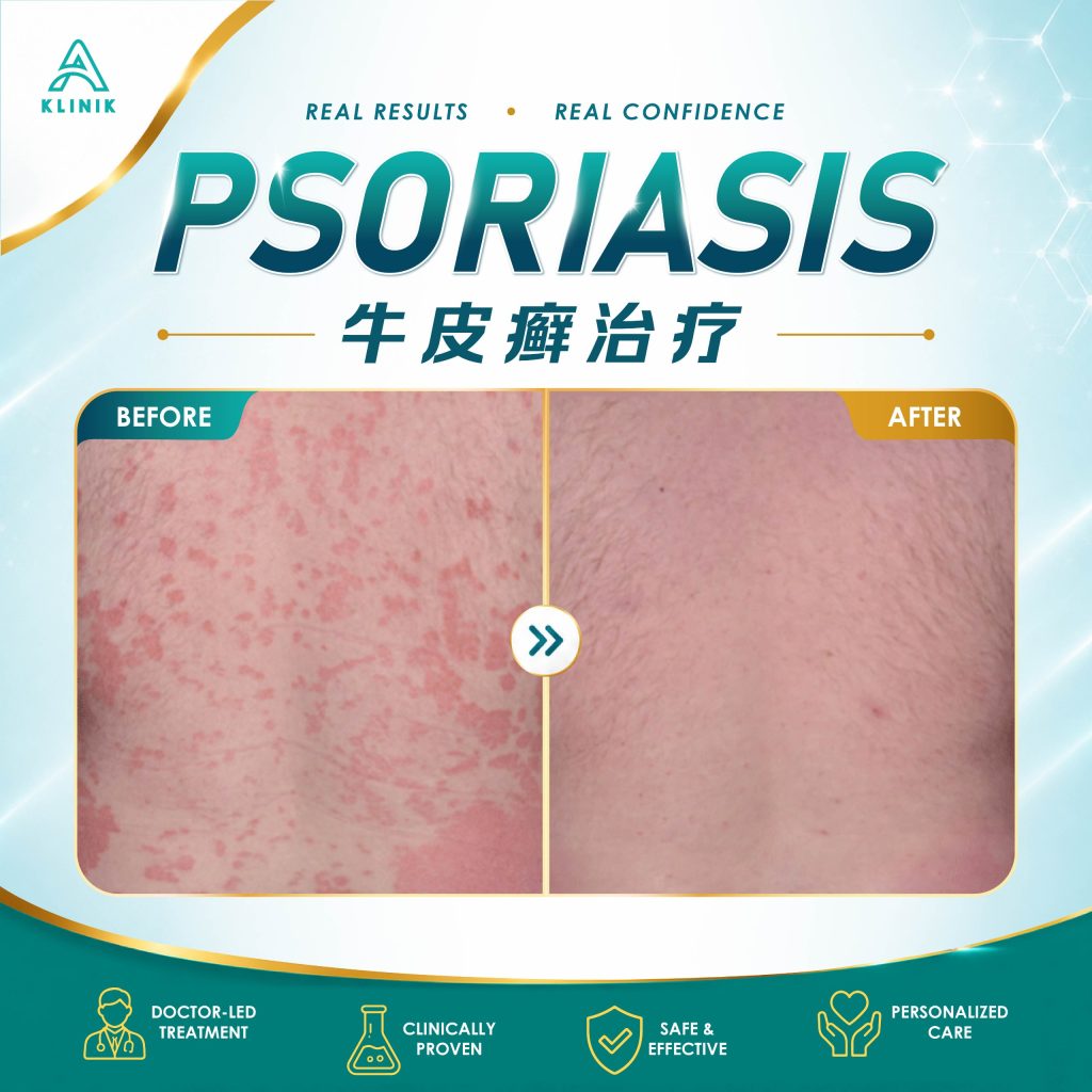 skin clinic in penang kl & selangor