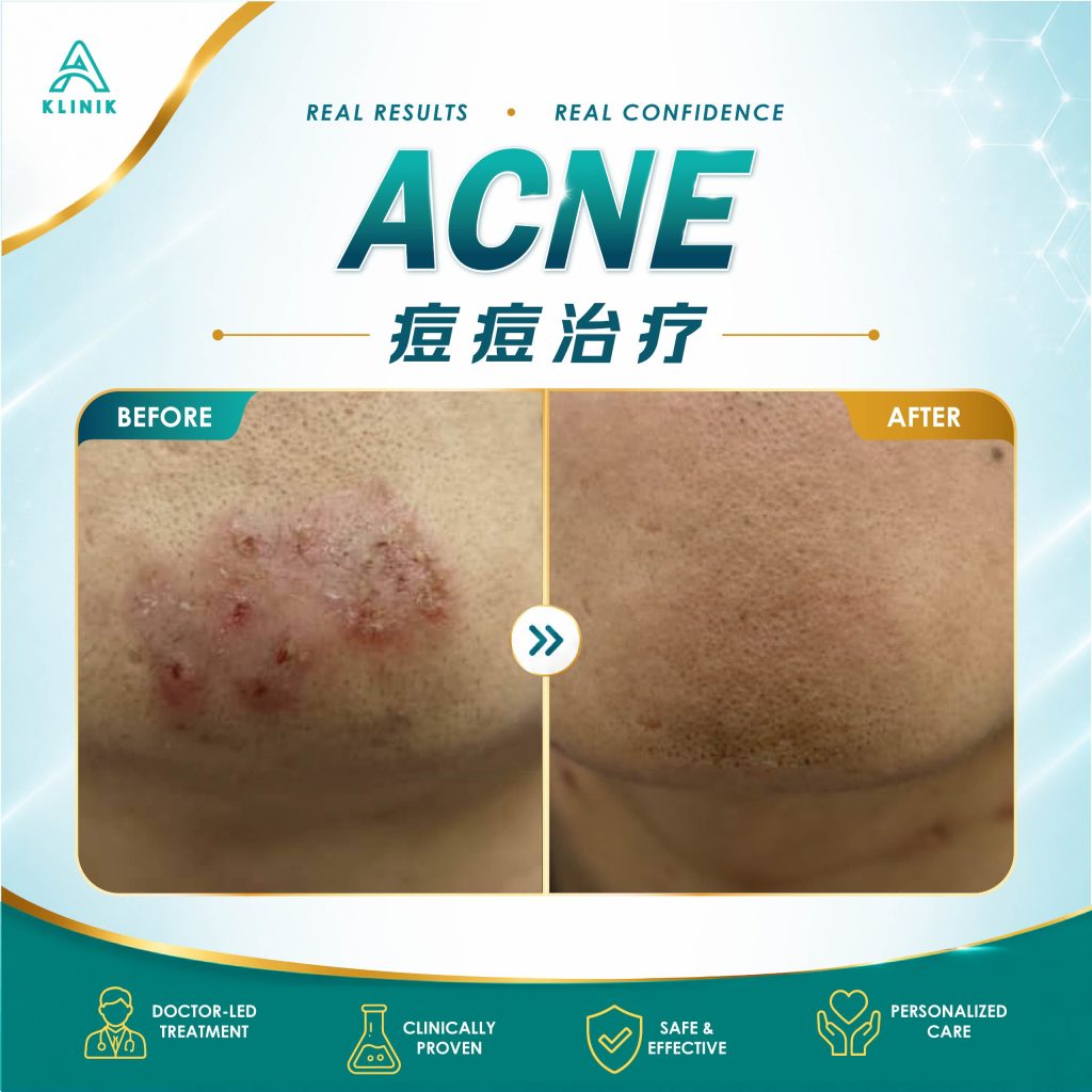 skin clinic in penang kl & selangor