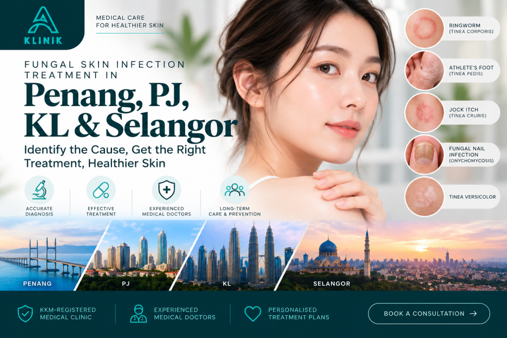 Fungal skin infection treatment in Penang, PJ, KL & Selangor at A Klinik Medical