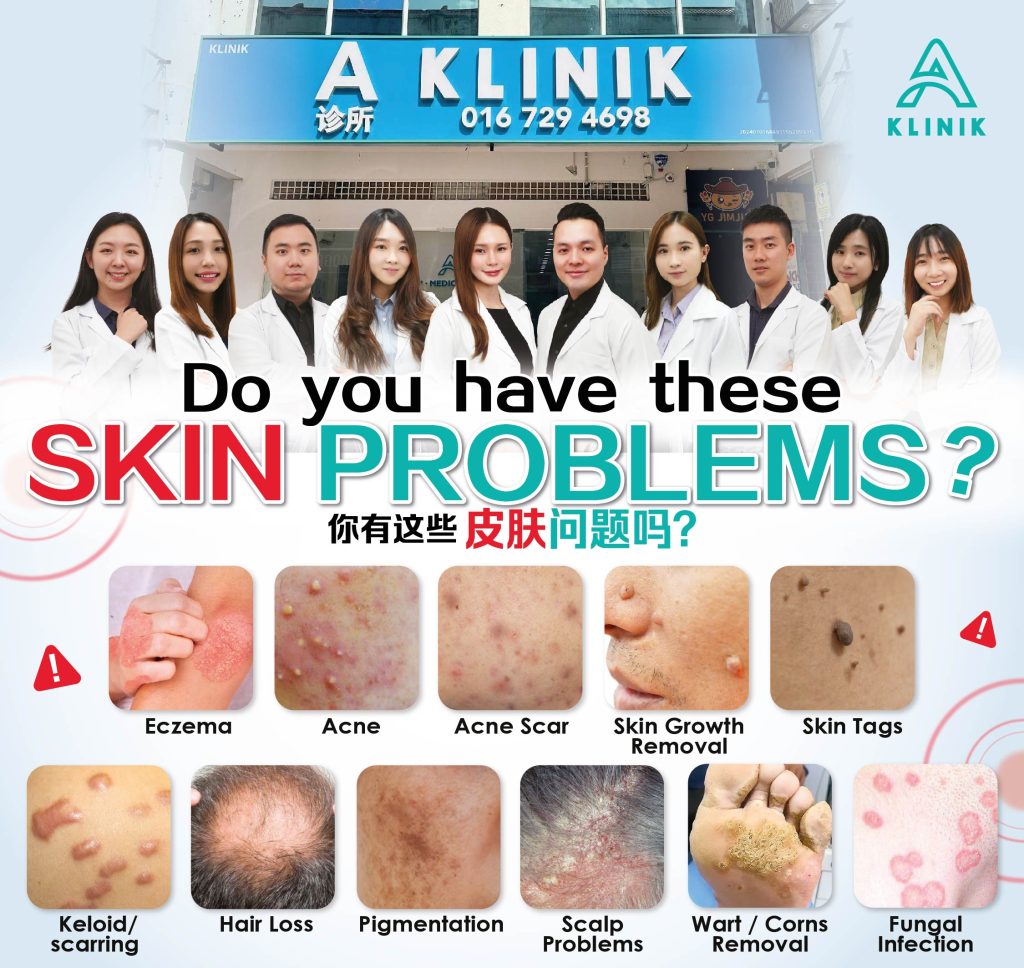 Dermatology skin clinic in Penang, PJ, KL & Selangor – A Klinik Medical